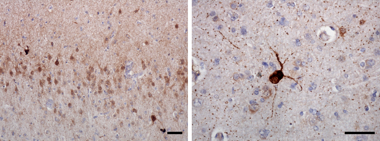 Slika 1. nNOS protein v pasjih možganih. Slika prikazuje značilno obarvane živčne celice (rjavo) v čelnem režnju 16 letnega shih-tzuja s pasjo kognitivno motnjo. Merili sta dolgi 50 µm.